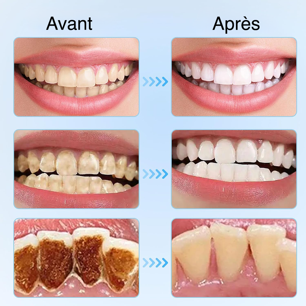 Dentifrice Blanchissant Niacinamide