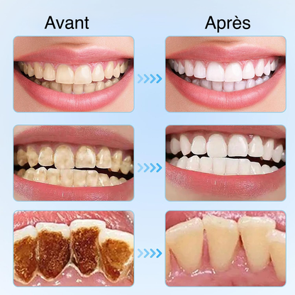 Dentifrice Blanchissant Niacinamide